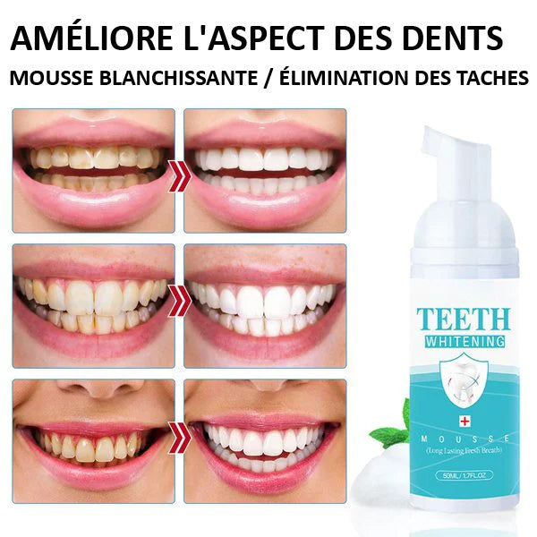 Mousse Blanchiment Dentaire - WhiteCare
